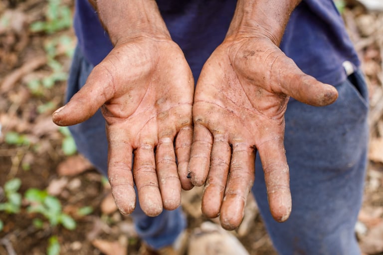 The overworked hands of a peasant. The hands of an elderly farmer disfigured by hard physical labor